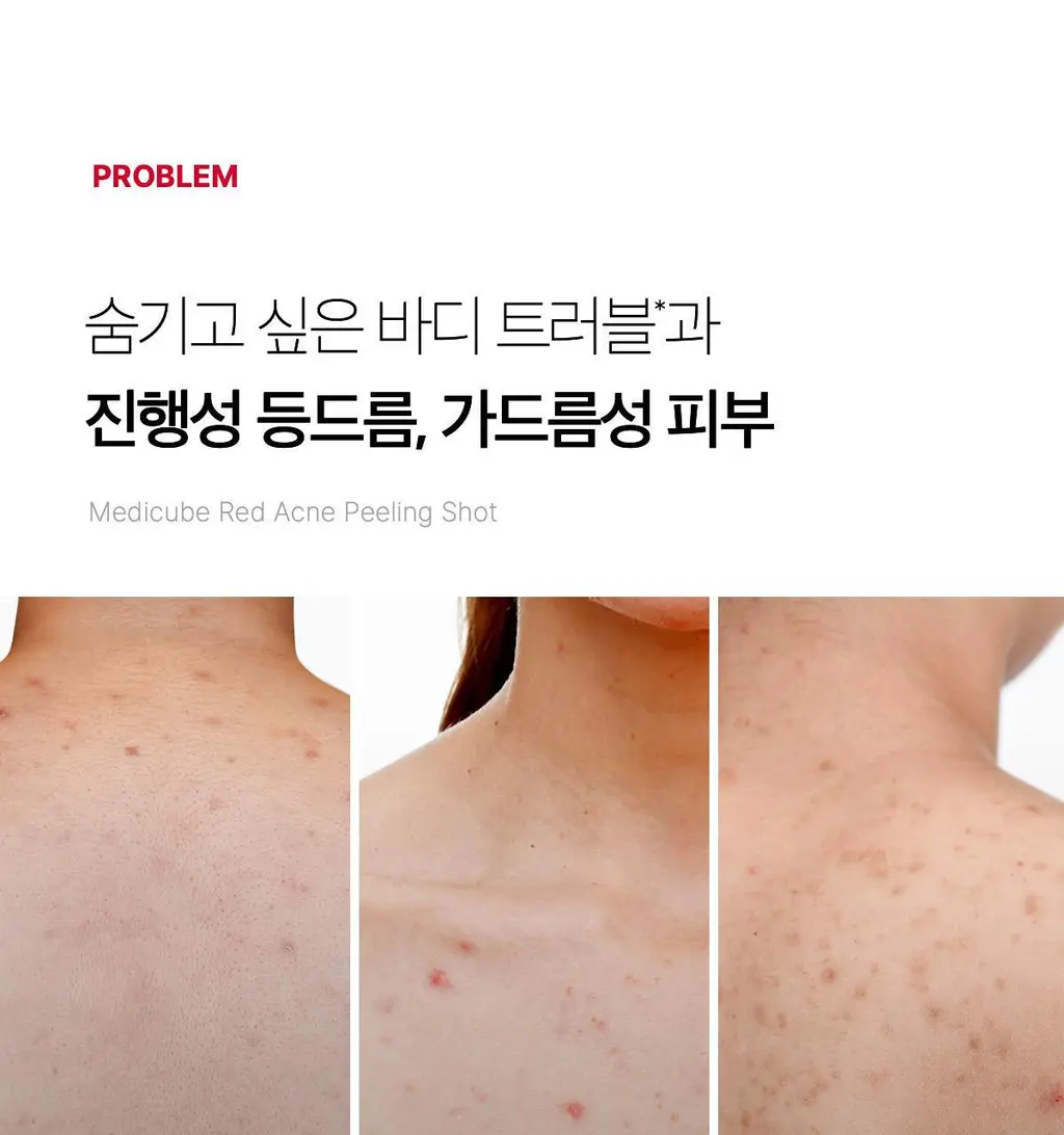 [NEW/바디트러블 케어] 메디큐브 레드 아크네 바디 필링 샷 110g 상세페이지 7